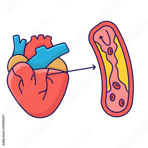 Heart disease