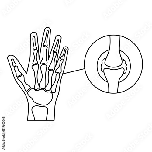 Arthritis icon