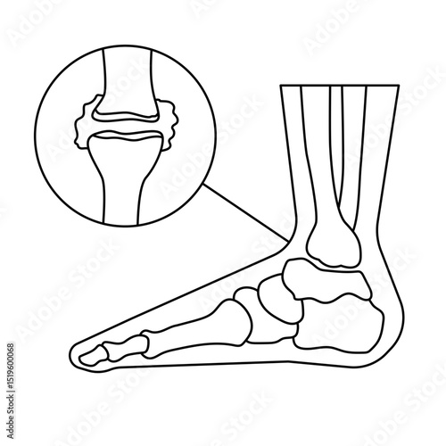 Arthritis icon