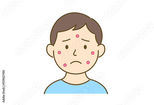 Illustration of a Man Troubled by Acne