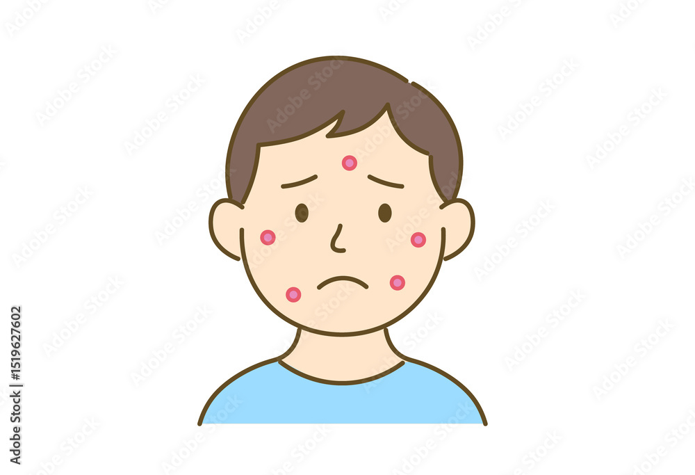 Illustration of a Man Troubled by Acne Illustration of a Man Troubled by Acne