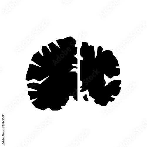 Alzheimer disease