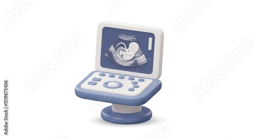 3D Ultrasound Machine with Fetus on Screen – Medical Imaging Illustration
