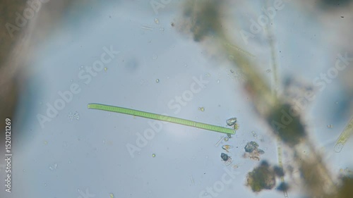 The amazing world of microbiology. Different bacteria, microbes and single-celled microorganisms are visible through a microscope. High-quality video.	
