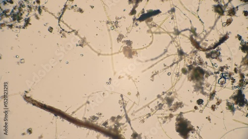 The amazing world of microbiology. Different bacteria, microbes and single-celled microorganisms are visible through a microscope. High-quality video.	
