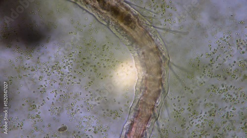 The amazing world of microbiology. Different bacteria, microbes and single-celled microorganisms are visible through a microscope. High-quality video.	
