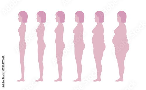 Side view profile. Standing woman's body losing weight. Comparison of weight changes. Full-length female body with different obesity.