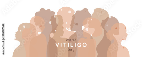 World Vitiligo day banner template. Diverse women men with vitiligo patches. Human silhouettes of various nationality. Skin diversity. Body positive and self love. People different genders and age