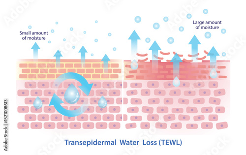 Comparison of transepidermal water loss illustration isolated on white background. Skin barrier in healthy state, TEWL small amount of moisture and damaged skin state, TEWL large amount of moisture.