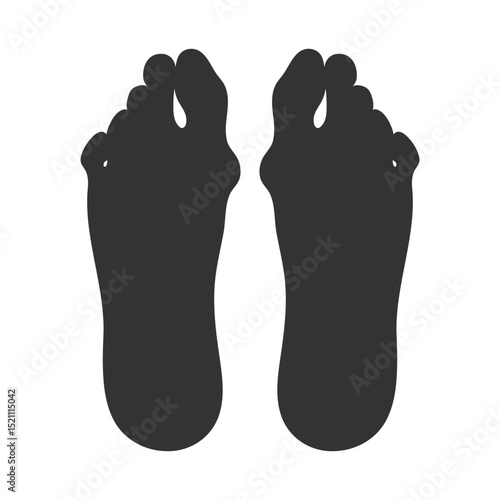 Silhouette of feet sole with a Hallux valgus deformation. Bunion of a big toe. Vector illustration