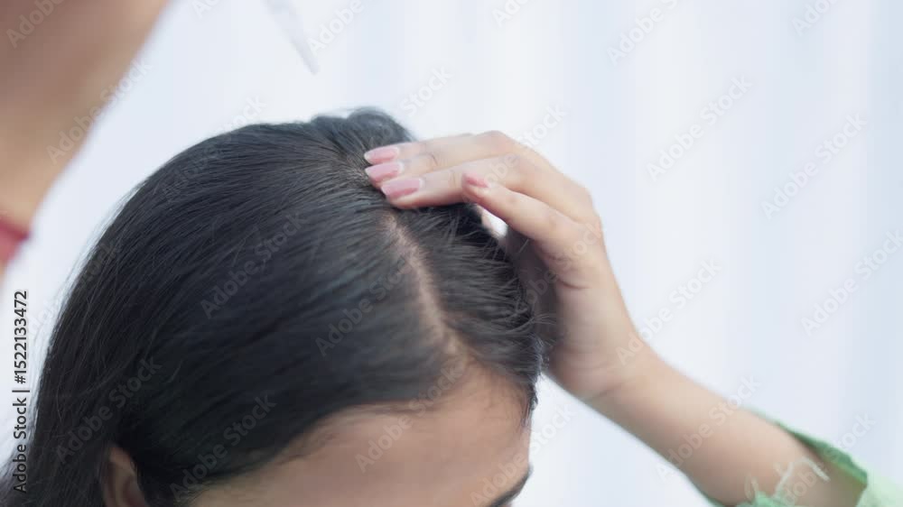 Androgenic alopecia, essential oil, a woman applying hair serum with a dropper on her scalp and massaging to treat hairloss.