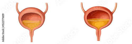Urinary bladder anatomy showing full and empty states in human anatomy study