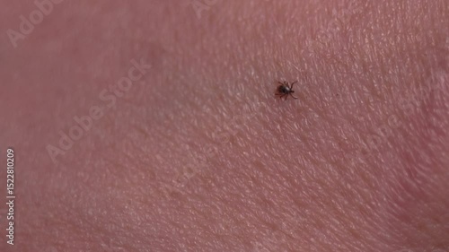 A dangerous tick crawls on the skin of a hand close up. An encephalitis tick is looking for a place to bite. A blood sucking insect and blood poisoning