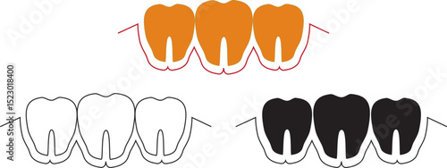 Teeth, orthodontic treatment, vector illustration isolated on white background. White teeth with brackets, braces. Dental care and dentistry. Teeth arrangement