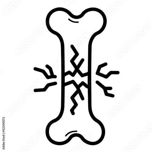 Broken bone illustration showing fracture line. Detailed illustration of bone fracture with crack lines. Medical illustration perfect for traumatology, orthopedics, or pregnancy related materials.