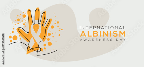 International Albinism Awareness Day, held on 13 June.
