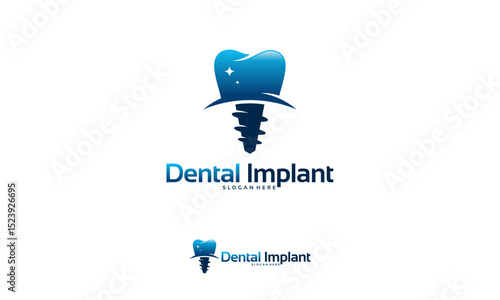 Dental implant logo designs concept vector, Dental Care logo template