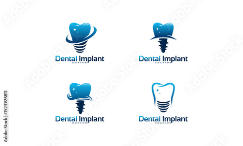 set of Dental implant logo designs concept vector, Dental Care logo template