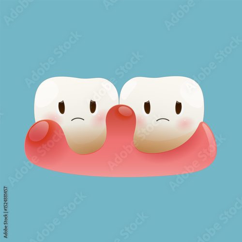 illustrstion of gum disease. Periodontal disease. Periodontitis disease. Vector and Cartoon