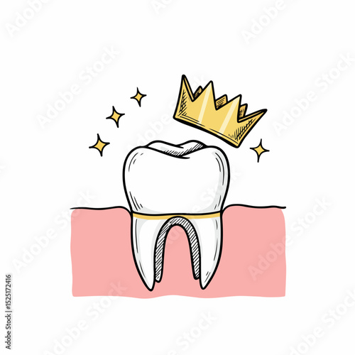 Healthy tooth with golden crown. Sparkling clean tooth with gold crown illustration. Dental crown on healthy tooth perfect for dental clinic brochures.