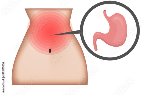 Stomach ache showing highlighted area and close up of organ