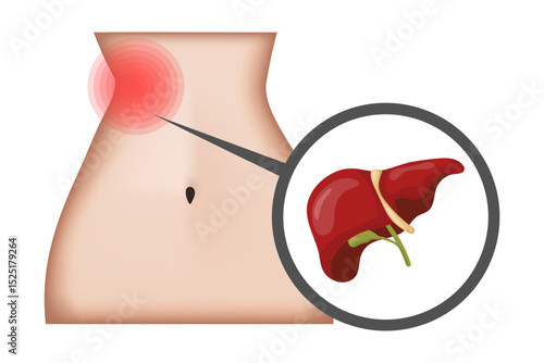 Liver Pain Showing Painful Area on Female Body and Close up of Liver
