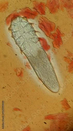 time laps footage of super magnification of demodex face mite showing internal structures under the microscope