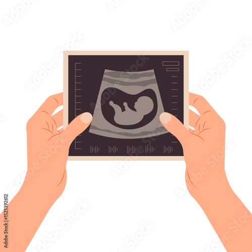 Pregnancy screening. Ultrasound of the baby. Female hands holding a photo of a baby on ultrasound scan in the womb.