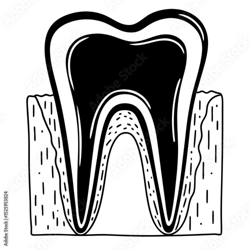 Illustration of a molar tooth with internal structure and root canal shown in black and white style