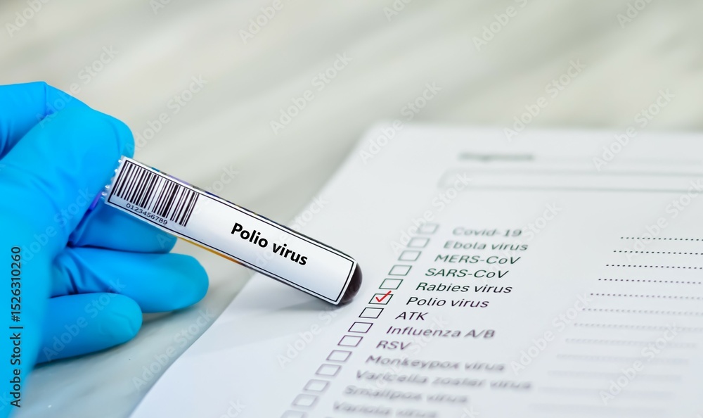 Naklejka premium Blood sample tube and paper order request for polio virus.