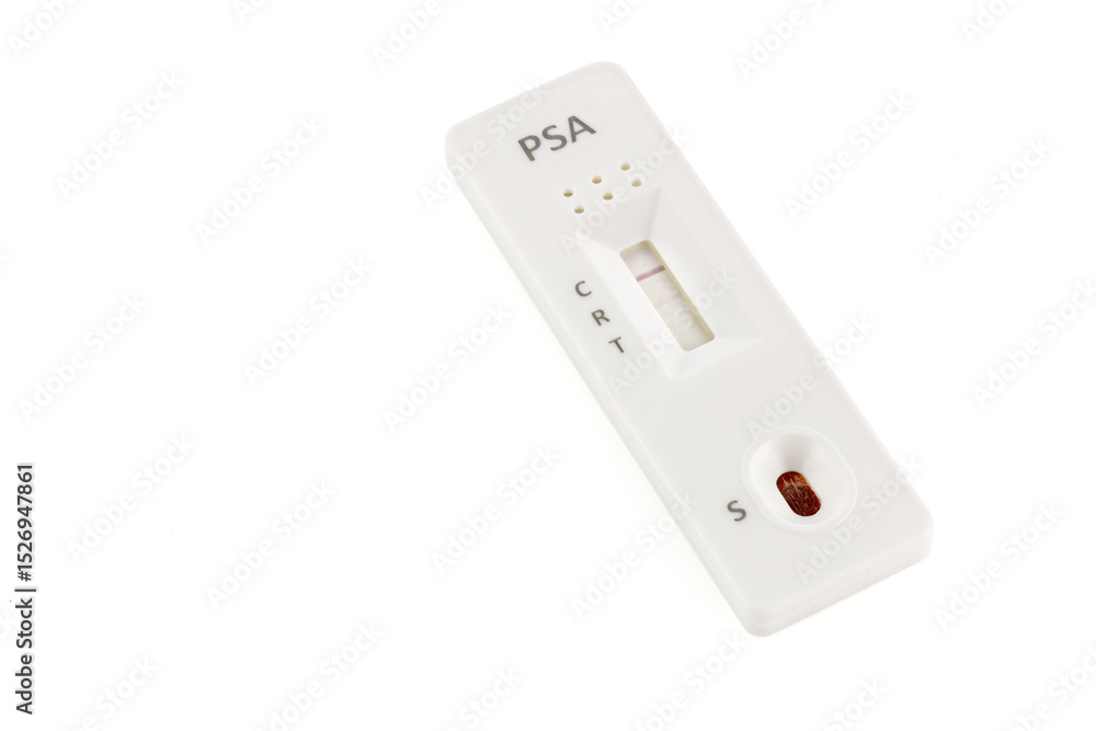 Rapid diagnostic test for PSA (Prostate Specific Antigen) with a negative result. Rapid test cassette. Rapid diagnostic test for PSA (Prostate Specific Antigen) with a negative result. Rapid test cassette.