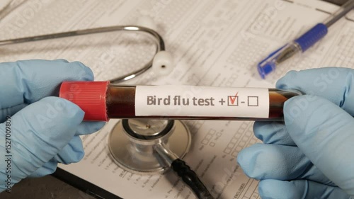 Doctor holding positive bird flu test tube
