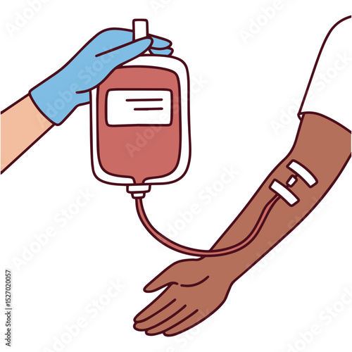 Dark black brown skinned person. Medical illustration showing blood transfusion into a dark-skinned arm by a gloved hand, symbolizing emergency care, donation, or hospital aid