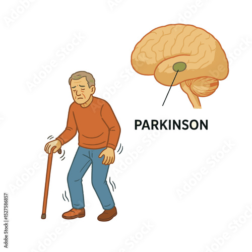 Parkinson's man with a cane