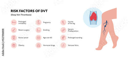 Deep vein thrombosis for healthcare infographic. Vector outline icon set illustration. Risk factor of DVT. Woman leg with thromb in blood vessel symbol. Design for health care, education