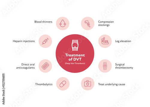 Deep vein thrombosis for healthcare infographic. Vector outline icon set illustration. Treatment of DVT. Blood vessel with thromb symbol. Design for health care, education