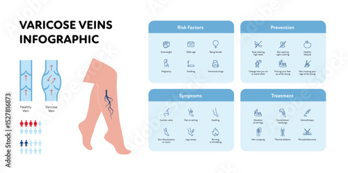 Varicose vascular disease for healthcare infographic. Vector outline icon set illustration. Risk factor, prevention, symptoms, treatment of DVT. Gender probability. Design for health care, education