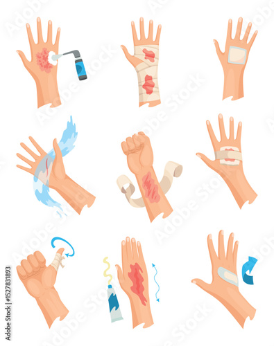 Hands injured skin and procedures of bandaging and wound cleaning. First aid for wound. Medicine cure or treatment. First emergency help for human hand trauma