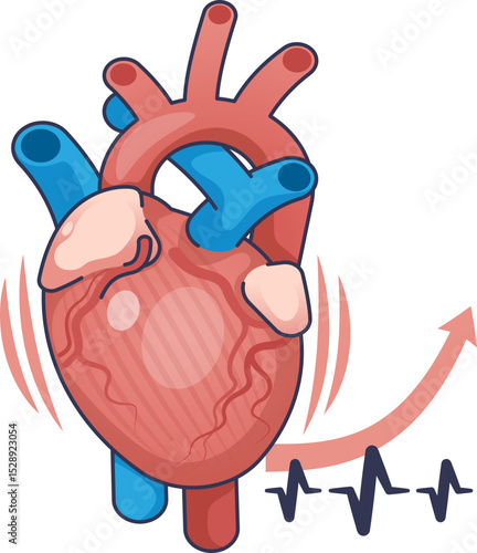 Illustration of a heart with increased rate, showing arteries and heartbeat graph.