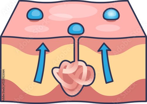 Illustration of sweat glands in skin, showing sweat production and release.