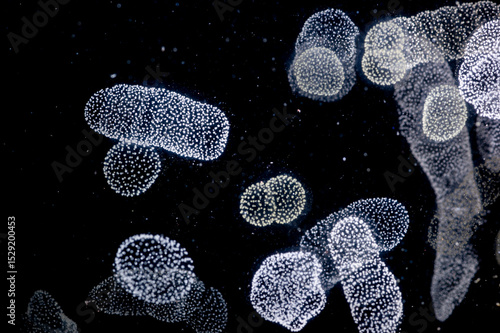 A colony of Rhizaria, an important group of large zooplankton Rhizaria make up some 33 percent of large zooplankton in the ocean, and more than 5 percent of the total marine biomass