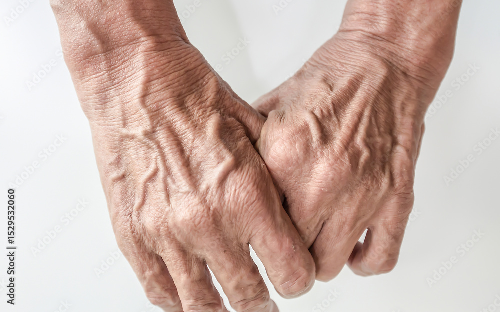 Fototapeta premium Hand and finger man is rough skin and wrinkles. Gesture on a whi