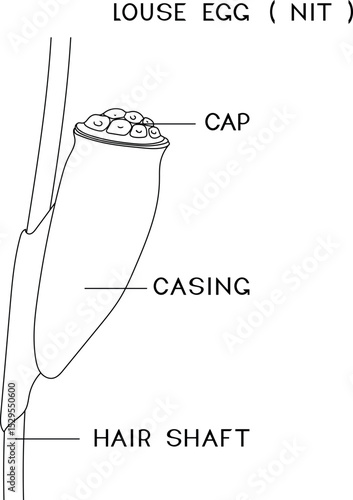 Coloring page with structure of head louse egg (nit) attached to a hair for biology lesson