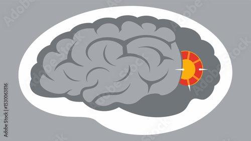 An MRI scan highlighting areas of reduced brain tissue density and grey matter thinning characteristic of mild cognitive impairment.. Vector illustration