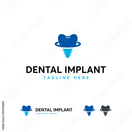 Dental implant  design with a tooth and a screw.