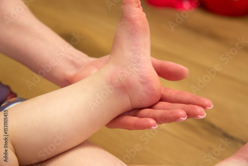 Wallpaper Mural A child is sitting on the floor inside a cozy living room, revealing a pronounced red mosquito bite on their knee Torontodigital.ca