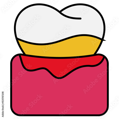 Gingivitis