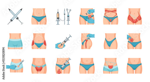 Vector Icons Set of Illustrated Guide to Female Body Contouring Procedures. Vector Illustrations