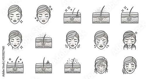 Vector Icons Set of Skincare Issues Illustrated Skin Problems and Conditions with Hair Follicle Diagrams. Vector Illustrations