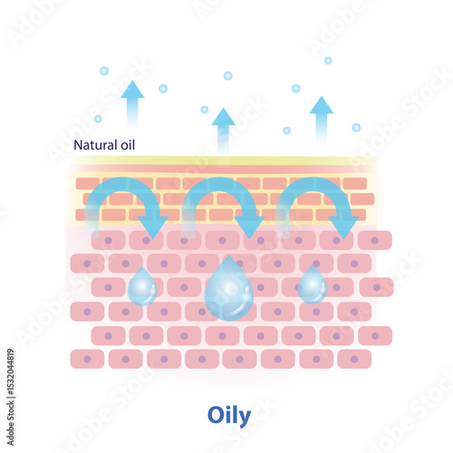 The mechanism of oily skin illustration on white background. Cross section of natural oil on skin layer acts as an occlusive that help trap in water and hydration, less trans epidermal water loss.